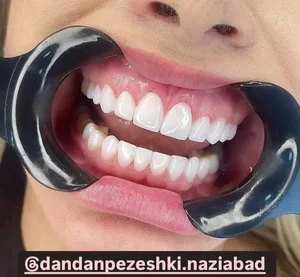 دندانپزشکی پرستیژ