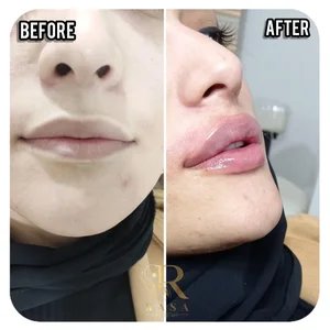 کلینیک زیبایی راسا 3
