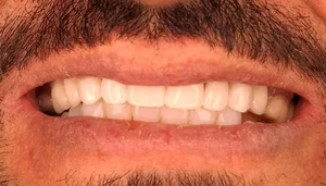 دندانسازی صباغ