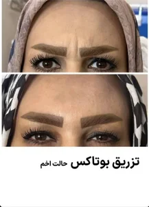 مرکز لیزر و زیبایی زروانی 2