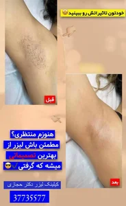 مرکز لیزر مو های زائد کندلا دکتر حجازی 3