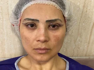 کلینیک پوست، مو، زیبایی و لاغری دکتر احمد قدیانی فر در زعفرانیه و ولنجک تهران 3