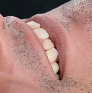 مارال دنتال