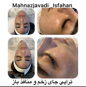 خدمات تخصصی  پوست و مو  مهناز جوادی 3
