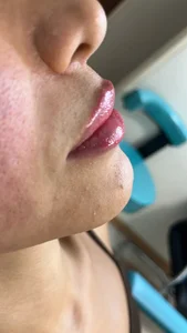 کلینیک زیبایی و لاغری مهشید ذاکری 4