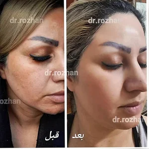 کرمهای ضدلک و جوانساز روژان