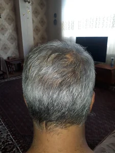 کلینیک فوق تخصصی پوست مو زیبایی ارم