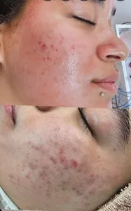 خدمات پاکسازی پوست کامرانی 3