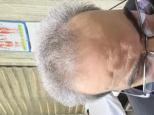 خدمات احیاء مو رشیدی 2
