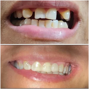 دندانپزشکی دکتر پیرزاد 2