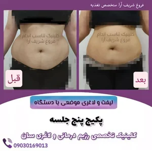 کلینیک تخصصی لاغری فروغ شریف ارا 2