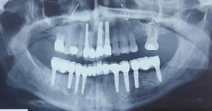مطب دندانپزشکی دکتر فرناز فتاحی