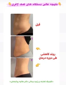 کارشناس تغدیه هانیه روانبخش 5