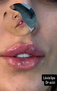 کلینیک زیبایی آسا 2