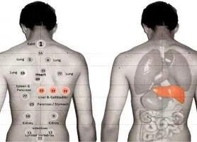 حجامت میکرونیدلینگ