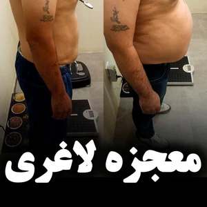 مطب تغذیه و رژیم درمانی 3