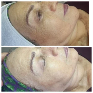فیشال و پاکسازی پوست مرضیه صالحی 5