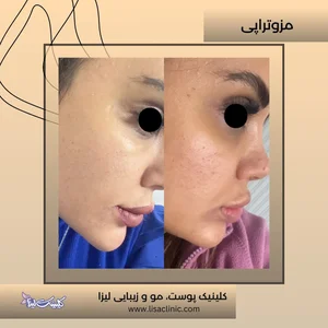 کلینیک لیزا 5