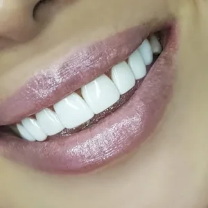 دندانپزشکی دنت پلاس 3