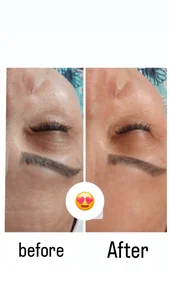 فیشال وپاکسازی پوست ومو سمیه ابراهیمی 2