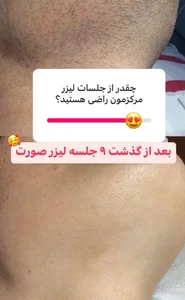 مرکز لیزر دکتر سمیه حجازی 3