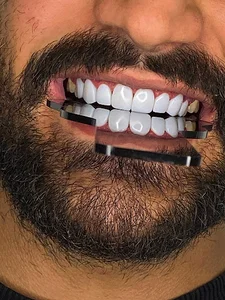 دندانپزشکی دنتال صدف