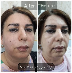 کلینیک پوست و مووزیبایی دالیا 2