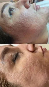 مرکز فیشیال آرزو نظیفی 3