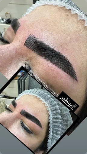 سالن تخصصی فیبروز ابرو