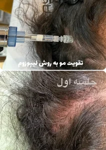 آکادمی پوست وموالماس سبز 2