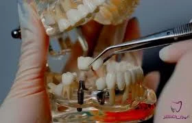 مطب دندانپزشکی دکتر یاسمن ال یاسین( متخصص جراحی لثه و ایمپلنت)
