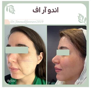 مطب دکتر ژینوس خسروی | زیبایی پوست و مو لیزر