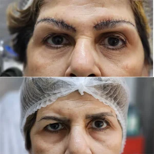 کلینیک زیبایی کاشت مو و ابرو ری رویال 3