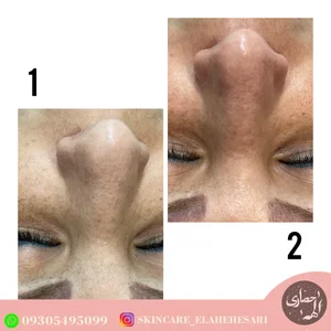 بیوتی تراپیست الهه حصاری 2