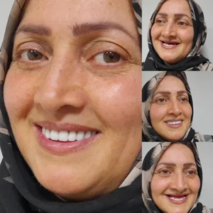 دندانسازی بنی هاشم 5