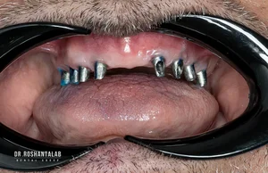 مطب دکتر سید حسن دیباجی