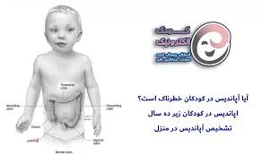 تفاوت درد شکم با آپاندیس در کودکان | کودک الکترونیک