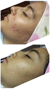 فیشال و پاکسازی پوست مرضیه صالحی 4