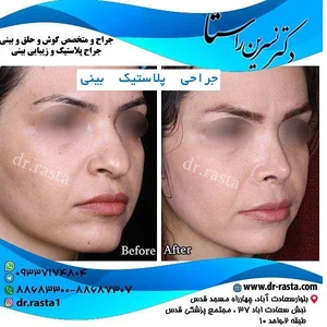 کلینیک زیبایی نفیس
