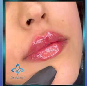 کلینیک پوست مو زیبایی دکتر سیفوری 2