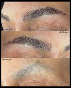 خدمات تخصصی تاتوی صورت ستاره 2