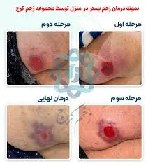 کلینیک درمان زخم راهداری