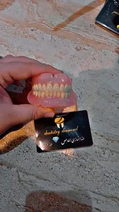 دندانسازی الماس غلامی