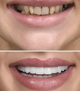 دندانپزشکی زیبایی دکترشجاعیفر 2