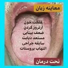 طب زبانشناسی حمزه پور