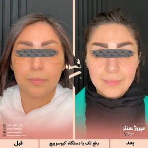 مرکز زیبایی میروژ سنتر