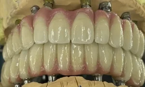 Khanlari Dental Lab