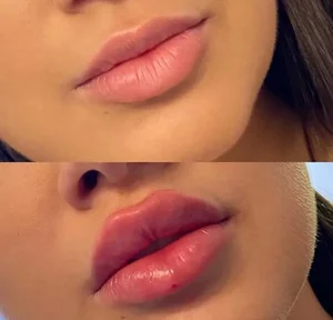 مطب پوست مو زیبایی السا 2