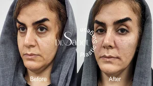 مطب دکتر حسن گل محمدی جراح زیبایی