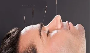 دکتر فرخنده رهنما متخصص لیزر و طب سوزنی